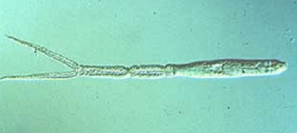 Microscopic parasite causing swimmer’s itch in some Iowa lakes